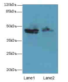 ZNF821 Antibody - Western blot. All lanes: ZNF821 antibody at 8 ug/ml. Lane 1: MCF7 whole cell lysate. Lane 2: HCT116 whole cell lysate. Secondary Goat polyclonal to Rabbit IgG at 1:10000 dilution. Predicted band size: 47 kDa. Observed band size: 47 kDa.