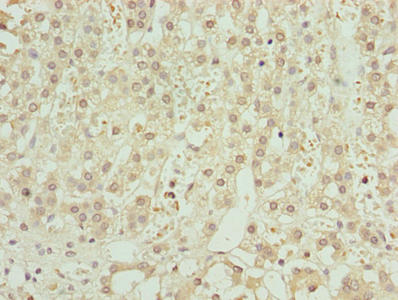 ZNF821 Antibody - Immunohistochemistry of paraffin-embedded human adrenal gland tissue using ZNF821 Antibody at dilution of 1:100
