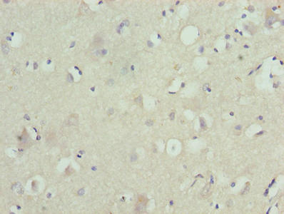 ZNF821 Antibody - Immunohistochemistry of paraffin-embedded human brain tissue using ZNF821 Antibody at dilution of 1:100