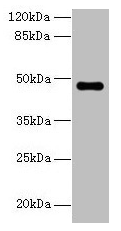 ZNF821 Antibody - Western blot All lanes: ZNF821 antibody at 8µg/ml Lane 1: MCF-7 whole cell lysate Lane 2: HCT116 whole cell lysate Secondary Goat polyclonal to rabbit IgG at 1/10000 dilution Predicted band size: 47, 43 kDa Observed band size: 47 kDa