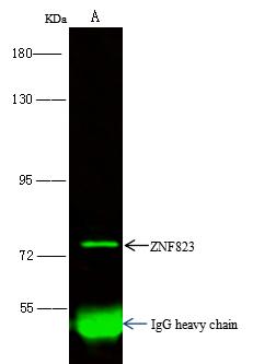 ZNF823 Antibody - ZNF823 was immunoprecipitated using: Lane A: 0.5 mg Jurkat Whole Cell Lysate. 1 uL anti-ZNF823 rabbit polyclonal antibody and 15 ul of 50% Protein G agarose. Primary antibody: Anti-ZNF823 rabbit polyclonal antibody, at 1:500 dilution. Secondary antibody: Dylight 800-labeled antibody to rabbit IgG (H+L), at 1:5000 dilution. Developed using the odssey technique. Performed under reducing conditions. Predicted band size: 67 kDa. Observed band size: 75 kDa.