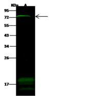 ZNF823 Antibody - Anti-ZNF823 rabbit polyclonal antibody at 1:500 dilution. Lane A: Jurkat Whole Cell Lysate. Lysates/proteins at 30 ug per lane. Secondary: Goat Anti-Rabbit IgG H&L (Dylight 800) at 1/10000 dilution. Developed using the Odyssey technique. Performed under reducing conditions. Predicted band size: 68 kDa. Observed band size: 72 kDa. (We are unsure as to the identity of these extra bands.)