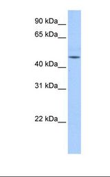 ZNF829 Antibody - Fetal liver cell lysate. Antibody concentration: 0.5 ug/ml. Gel concentration: 12%.  This image was taken for the unconjugated form of this product. Other forms have not been tested.