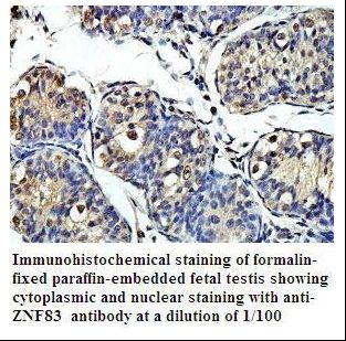 ZNF83 / HPF1 Antibody