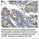 ZNF83 / HPF1 Antibody