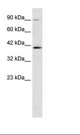 ZNF830 / CCDC16 Antibody - Jurkat Cell Lysate.  This image was taken for the unconjugated form of this product. Other forms have not been tested.