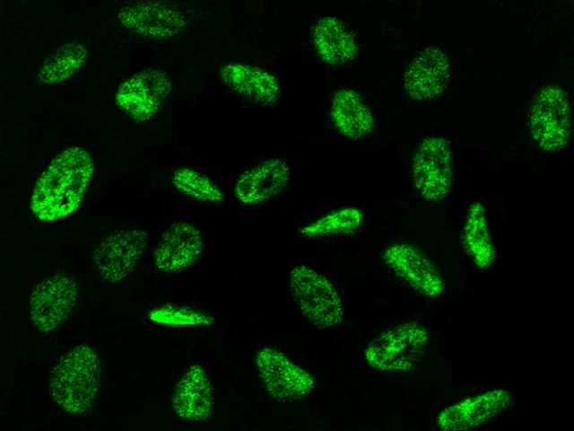 ZNF830 / CCDC16 Antibody - Immunofluorescence staining of ZNF830 in U251-MG cells. Cells were fixed with 4% PFA, permeabilzed with 0.1% Triton X-100 in PBS, blocked with 10% serum, and incubated with rabbit anti-Human ZNF830 polyclonal antibody (dilution ratio 1:1000) at 4°C overnight. Then cells were stained with the Alexa Fluor 488-conjugated Goat Anti-rabbit IgG secondary antibody (green). Positive staining was localized to nucleus.