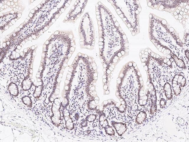 ZNF830 / CCDC16 Antibody - Immunochemical staining of human ZNF830 in human duodenum with rabbit polyclonal antibody at 1:1000 dilution, formalin-fixed paraffin embedded sections.
