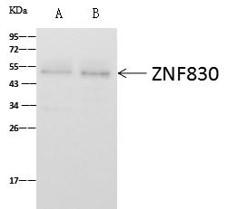 ZNF830 / CCDC16 Antibody - ZNF830 was immunoprecipitated using: Lane A: 0.5 mg Jurkat Whole Cell Lysate. Lane B: 0.5 mg HeLa Whole Cell Lysate. 4 uL anti-ZNF830 rabbit polyclonal antibody and 60 ug of Immunomagnetic beads Protein A/G. Primary antibody: Anti-ZNF830 rabbit polyclonal antibody, at 1:100 dilution. Secondary antibody: Goat Anti-Rabbit IgG (H+L)/HRP at 1/10000 dilution. Developed using the ECL technique. Performed under reducing conditions. Predicted band size: 42 kDa. Observed band size: 49 kDa.