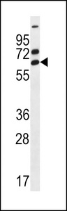 ZNF835 Antibody - ZNF835 Antibody western blot of A549 cell line lysates (35 ug/lane). The ZNF835 antibody detected the ZNF835 protein (arrow).