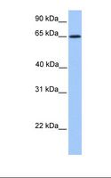 ZNF837 Antibody - Jurkat cell lysate. Antibody concentration: 1.0 ug/ml. Gel concentration: 12%.  This image was taken for the unconjugated form of this product. Other forms have not been tested.