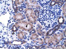 ZNF84 Antibody - ZNF84 antibody ARP35668_T100-NP_003419-ZNF84 (zinc finger protein 84) Antibody was used in IHC to stain formalin-fixed, paraffin-embedded human kidney.  This image was taken for the unconjugated form of this product. Other forms have not been tested.