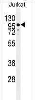 ZNF841 Antibody - ZNF841 Antibody western blot of Jurkat cell line lysates (35 ug/lane). The ZNF841 antibody detected the ZNF841 protein (arrow).