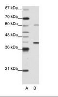 ZNF843 Antibody - A: Marker, B: HepG2 Cell Lysate.  This image was taken for the unconjugated form of this product. Other forms have not been tested.