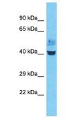 ZNF843 Antibody - ZNF843 antibody Western Blot of Lung Tumor. Antibody dilution: 1 ug/ml.  This image was taken for the unconjugated form of this product. Other forms have not been tested.