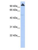 ZNF845 Antibody - ZNF845 antibody Western Blot of HepG2 cell lysate.  This image was taken for the unconjugated form of this product. Other forms have not been tested.