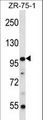 ZNF845 Antibody - ZNF845 Antibody western blot of ZR-75-1 cell line lysates (35 ug/lane). The ZNF845 antibody detected the ZNF845 protein (arrow).