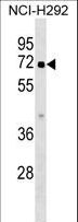 ZNF851 / ZBTB44 Antibody - ZBTB44 Antibody western blot of NCI-H292 cell line lysates (35 ug/lane). The ZBTB44 antibody detected the ZBTB44 protein (arrow).