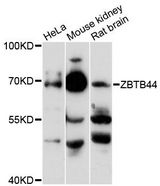 ZNF851 / ZBTB44 Antibody - Western blot analysis of extracts of various cell lines, using ZBTB44 antibody at 1:3000 dilution. The secondary antibody used was an HRP Goat Anti-Rabbit IgG (H+L) at 1:10000 dilution. Lysates were loaded 25ug per lane and 3% nonfat dry milk in TBST was used for blocking. An ECL Kit was used for detection and the exposure time was 90s.