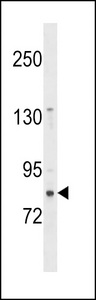 ZNF853 Antibody - ZNF853 Antibody western blot of Uterus tissue lysates (35 ug/lane). The ZNF853 antibody detected the ZNF853 protein (arrow).