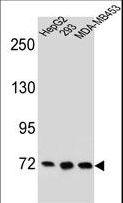 ZNF860 Antibody - ZNF860 Antibody western blot of HepG2,293,MDA-MB453 cell line lysates (35 ug/lane). The ZNF860 antibody detected the ZNF860 protein (arrow).