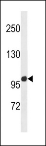 ZNF865 Antibody - ZNF865 Antibody western blot of mouse liver tissue lysates (35 ug/lane). The ZNF865 antibody detected the ZNF865 protein (arrow).