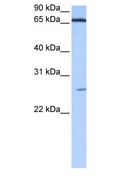 ZNF879 Antibody - ZNF879 antibody Western Blot of Human heart.  This image was taken for the unconjugated form of this product. Other forms have not been tested.
