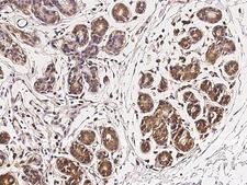 ZNF879 Antibody - Immunochemical staining of human ZNF879 in human breast with rabbit polyclonal antibody at 1:500 dilution, formalin-fixed paraffin embedded sections.