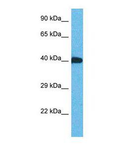 ZNF883 Antibody - Western blot of Human Thyroid Tumor. ZNF883 antibody dilution 1.0 ug/ml.  This image was taken for the unconjugated form of this product. Other forms have not been tested.