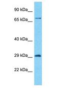 ZNF90 Antibody - ZNF90 antibody Western Blot of Fetal Liver. Antibody dilution: 1 ug/ml.  This image was taken for the unconjugated form of this product. Other forms have not been tested.