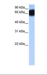 ZNF90 Antibody - Fetal heart cell lysate. Antibody concentration: 0.5 ug/ml. Gel concentration: 12%.  This image was taken for the unconjugated form of this product. Other forms have not been tested.