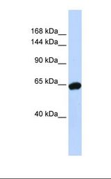 ZNF91 Antibody - Jurkat cell lysate. Antibody concentration: 1.0 ug/ml. Gel concentration: 6-18%.  This image was taken for the unconjugated form of this product. Other forms have not been tested.