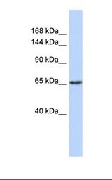 ZNF91 Antibody - Fetal muscle lysate. Antibody concentration: 1.0 ug/ml. Gel concentration: 6-18%.  This image was taken for the unconjugated form of this product. Other forms have not been tested.