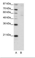 ZNF92 Antibody - A: Marker, B: HepG2 Cell Lysate.  This image was taken for the unconjugated form of this product. Other forms have not been tested.