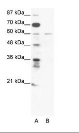 ZNF92 Antibody - A: Marker, B: Jurkat Cell Lysate.  This image was taken for the unconjugated form of this product. Other forms have not been tested.