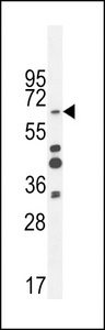 ZNF98 Antibody - ZNF98 Antibody western blot of MDA-MB435 cell line lysates (35 ug/lane). The ZNF98 antibody detected the ZNF98 protein (arrow).