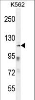 ZNF99 Antibody - ZNF99 Antibody western blot of K562 cell line lysates (35 ug/lane). The ZNF99 antibody detected the ZNF99 protein (arrow).