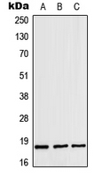 ZNHIT1 Antibody - Western blot analysis of ZNHIT1 expression in MOLT4 (A); mouse heart (B); rat heart (C) whole cell lysates.