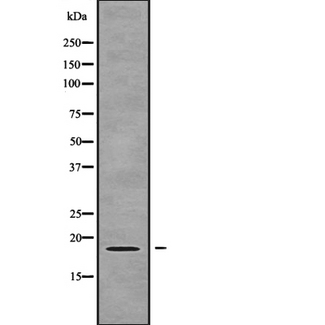 ZNHIT1 Antibody - Western blot analysis of ZNHIT1 using COLO205 whole cells lysates