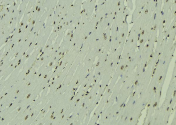 ZNHIT1 Antibody - 1:100 staining mouse muscle tissue by IHC-P. The sample was formaldehyde fixed and a heat mediated antigen retrieval step in citrate buffer was performed. The sample was then blocked and incubated with the antibody for 1.5 hours at 22°C. An HRP conjugated goat anti-rabbit antibody was used as the secondary.