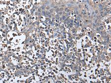 ZNHIT1 Antibody - Immunohistochemistry of paraffin-embedded Human tonsil tissue  using ZNHIT1 Polyclonal Antibody at dilution of 1:40(×200)