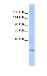 ZNHIT1 Antibody - MCF7 cell lysate. Antibody concentration: 1.0 ug/ml. Gel concentration: 6%-18%.  This image was taken for the unconjugated form of this product. Other forms have not been tested.