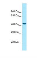 ZNHIT2 Antibody - Western blot of Human Fetal Stomach . ZNHIT2 antibody dilution 1.0 ug/ml.  This image was taken for the unconjugated form of this product. Other forms have not been tested.