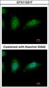 ZNHIT2 Antibody - Immunofluorescence of paraformaldehyde-fixed HeLa, using ZNHIT2 antibody at 1:500 dilution.
