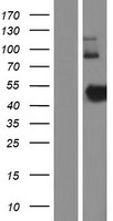 ZNHIT2 Protein - Western validation with an anti-DDK antibody * L: Control HEK293 lysate R: Over-expression lysate