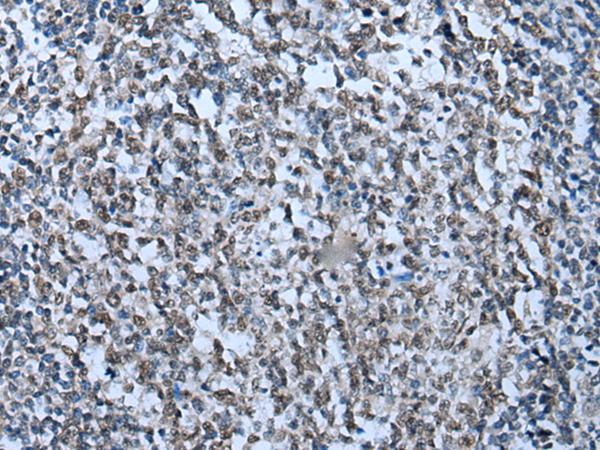 ZNHIT3 Antibody - Immunohistochemistry of paraffin-embedded Human tonsil tissue  using ZNHIT3 Polyclonal Antibody at dilution of 1:95(×200)