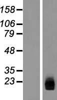 ZNHIT3 Protein - Western validation with an anti-DDK antibody * L: Control HEK293 lysate R: Over-expression lysate