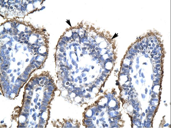 ZNHIT6 / C1orf181 Antibody - ZNHIT6 / C1orf181 antibody ARP34573_T100-NP_060423-FLJ20729 Antibody was used in IHC to stain formalin-fixed, paraffin-embedded human intestine.  This image was taken for the unconjugated form of this product. Other forms have not been tested.