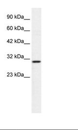 ZNHIT6 / C1orf181 Antibody - Jurkat Cell Lysate.  This image was taken for the unconjugated form of this product. Other forms have not been tested.