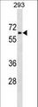 ZNHIT6 / C1orf181 Antibody - ZNHIT6 Antibody western blot of 293 cell line lysates (35 ug/lane). The ZNHIT6 antibody detected the ZNHIT6 protein (arrow).